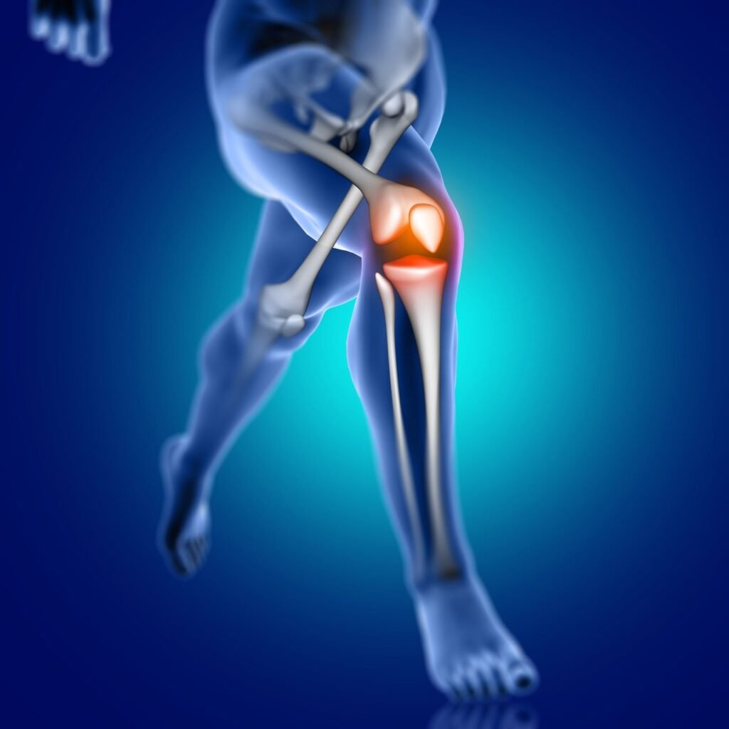 ACL Reconstruction Doctor in Sector 56 Gurugram