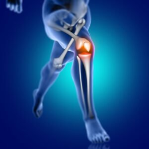 ACL Reconstruction Doctor in Sector 56 Gurugram