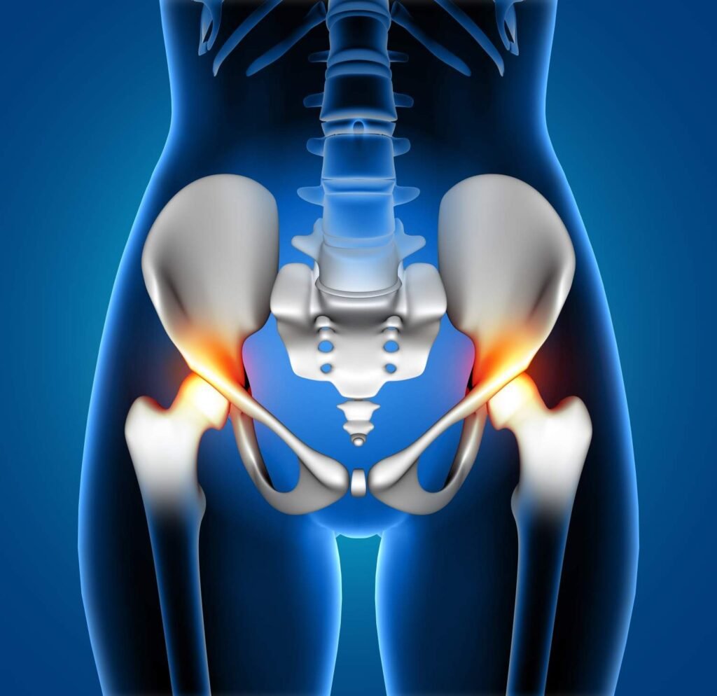 Hip Replacement Surgery in Sector 56 Gurugram
